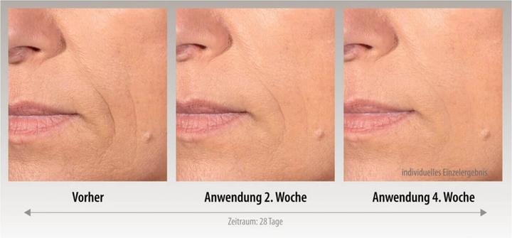 Actual product image And Shine - The Youth Patch (8 ml)