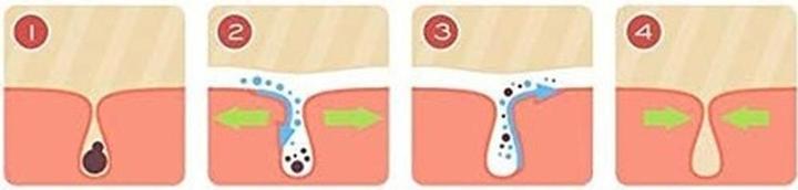 Actual product image Magicstripes Masks