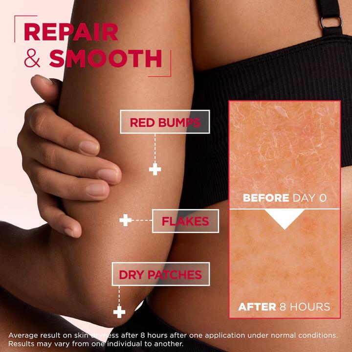 Image du produit Mixa Urea Cica Repair+ Renewing Cream For Very Dry And Rough Skin - 150 Ml (150 ml, Tonique visage)