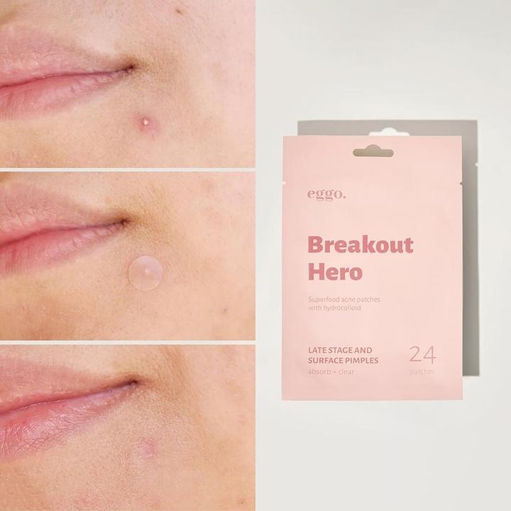 Actual product image Eggo Breakout Hero Hydrocolloid Pimple Patch 24 Pieces Pimple Cleaning Stickers for Mature Pimples A