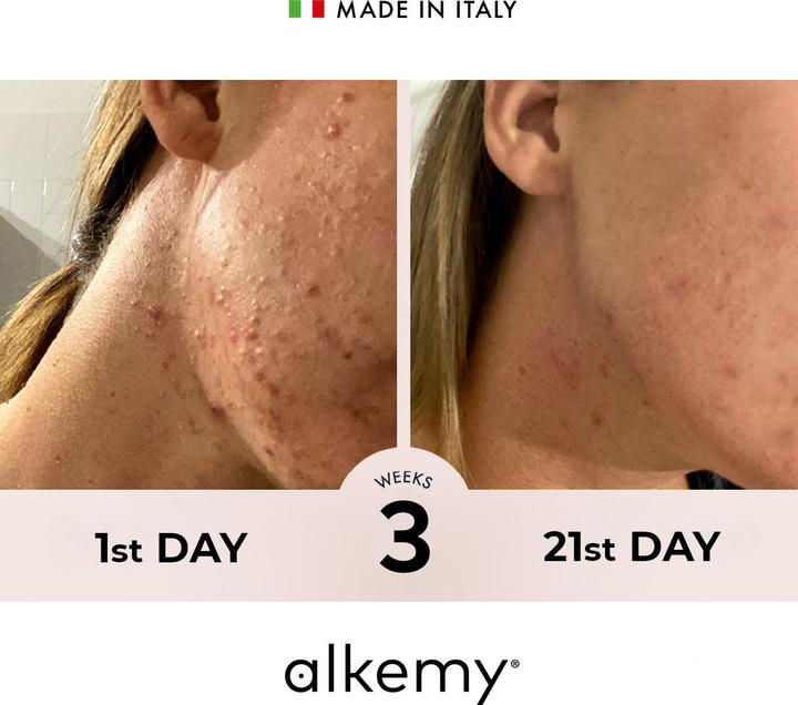 Actual product image Alkemy Cream against pimples and skin impurities (24h cream)