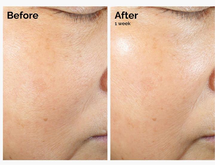 Image du produit The Ordinary Émulsion Micro de Lipides de Riz + Ectoine (120 ml)