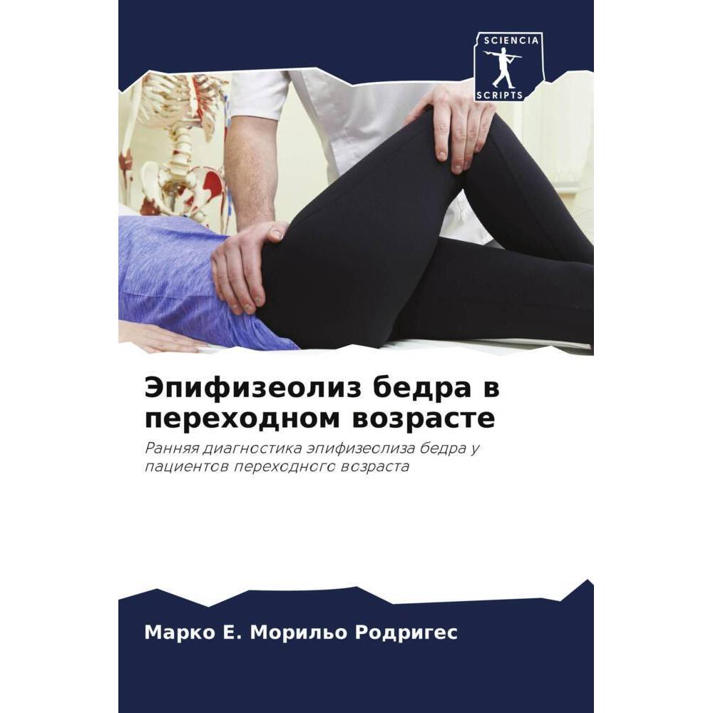 Jepifizeoliz bedra w perehodnom wozraste, Fachbücher von Marko E. Moril'o Rodriges