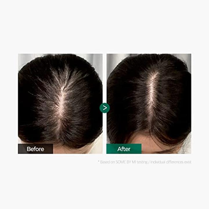 Image du produit Some By Mi (SOMEBYMI) Kit de démarrage Miracle Hair & Body (Kit de soins capillaires)