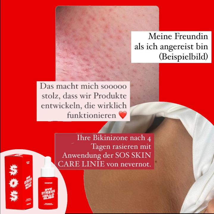 Actual product image NeverNot - SOS Skin Oil (30 ml, Intimate oil)