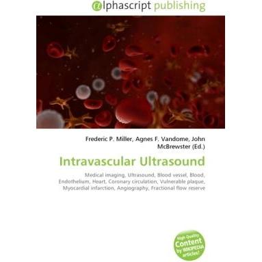 Intravascular Ultrasound, Fachbücher von Agnes F. Vandome, Frederic P. Miller, John McBrewster