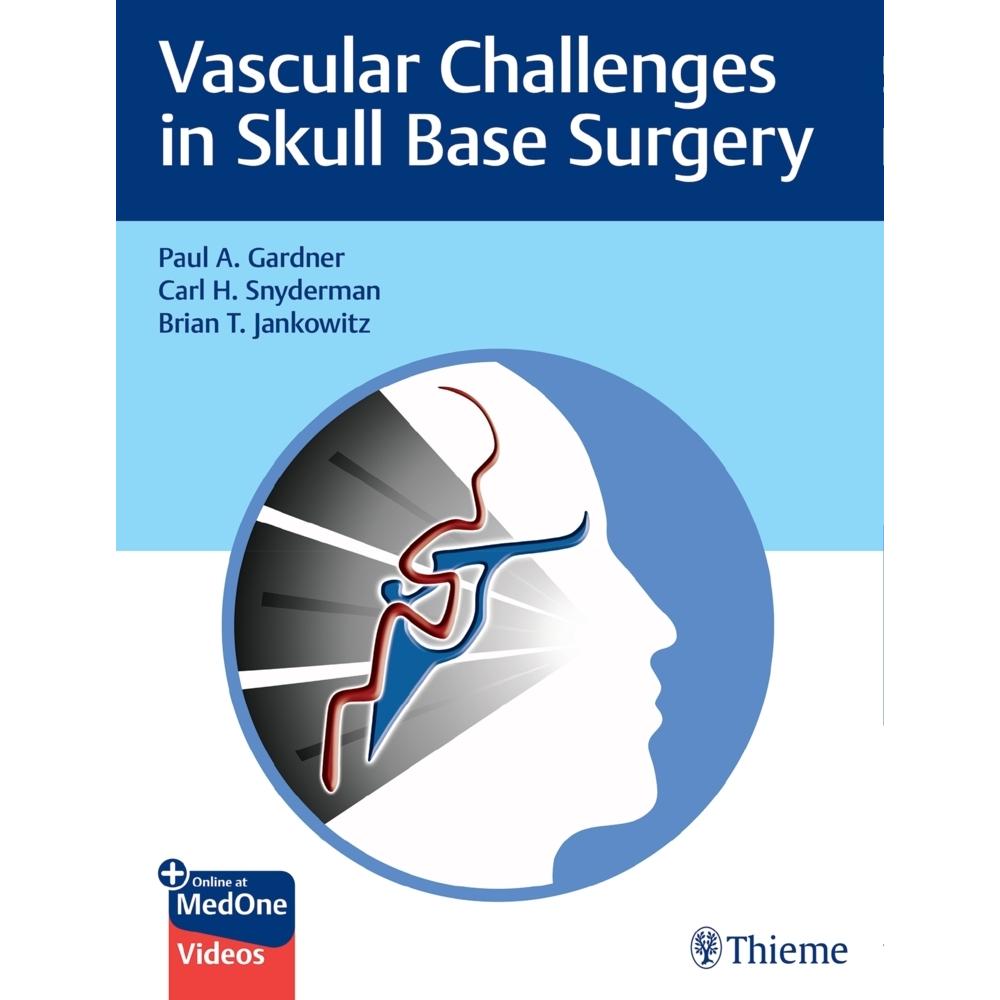 Gardner:Vascular Challenges in Skull Ba, Sachbücher von Paul Gardner, Carl Snyderman, Brian Jankowitz