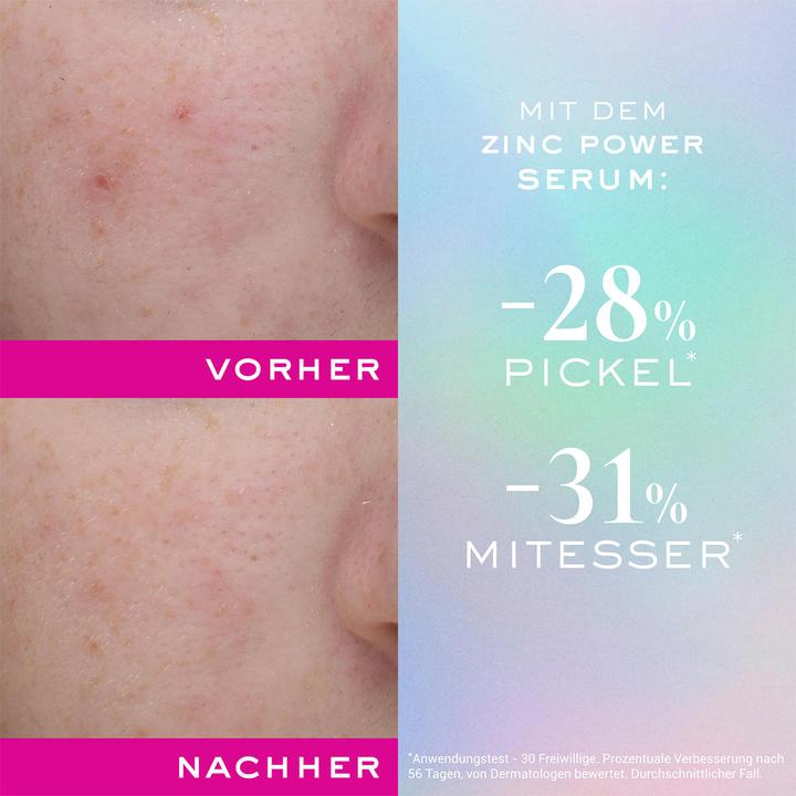 Immagine prodotto Nuxe Zinc Power Sérum A Imperf 30ml (30 ml)