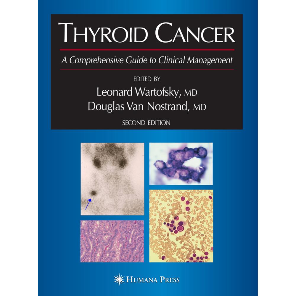 Thyroid Cancer, Fachbücher von Leonard Wartofsky, Douglas van Nostrand