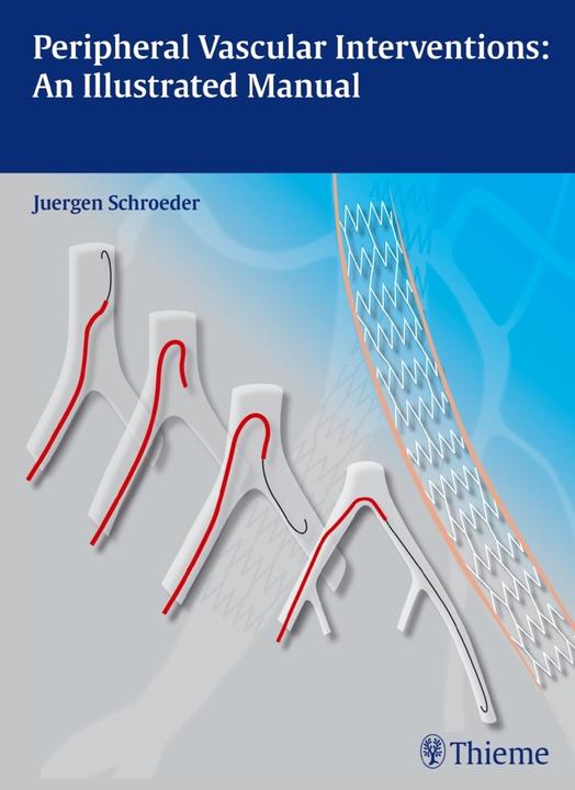 Produktbild Peripheral Vascular Interventions: An Illustrated Manual (Englisch, Jürgen Schröder, 2013)