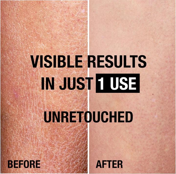 Actual product image Neutrogena Deep Moisture (Body lotion, 400 ml)