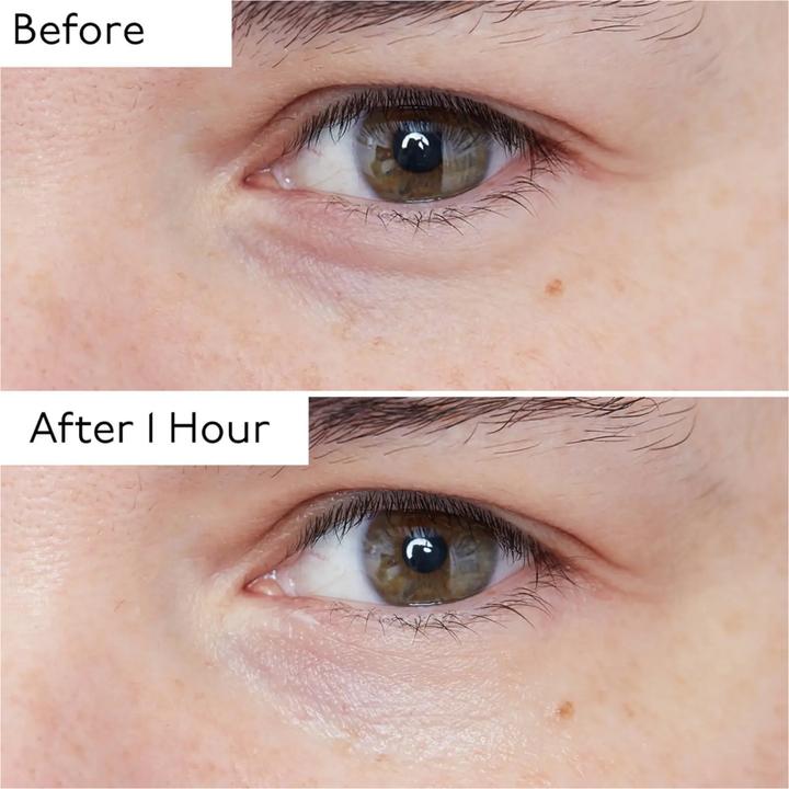 Image du produit By Terry Hyaluronic Global Eye Serum (Soin des yeux Sérum, 15 ml)
