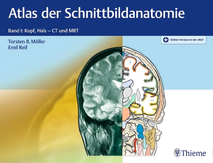 Produktbild Atlas der Schnittbildanatomie. Band 01 (Deutsch, Emil Reif, Torsten Bert Möller, 2018)