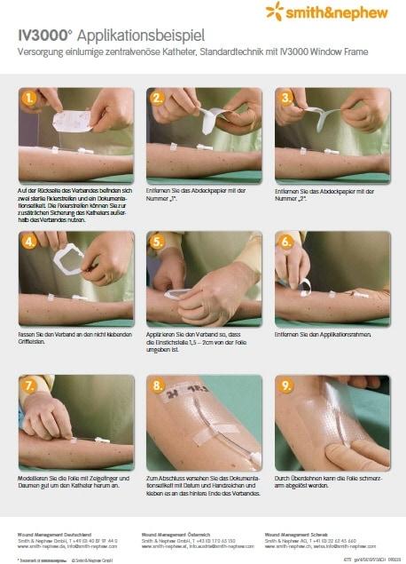 Produktbild Smith & nephew Kanülenfixation (100 x)