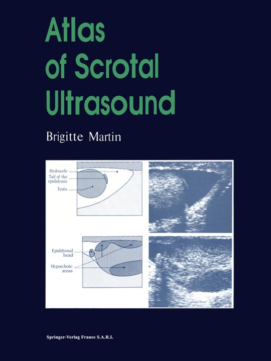 Produktbild Atlas of Scrotal Ultrasound (Englisch, Brigitte Martin, 2014)