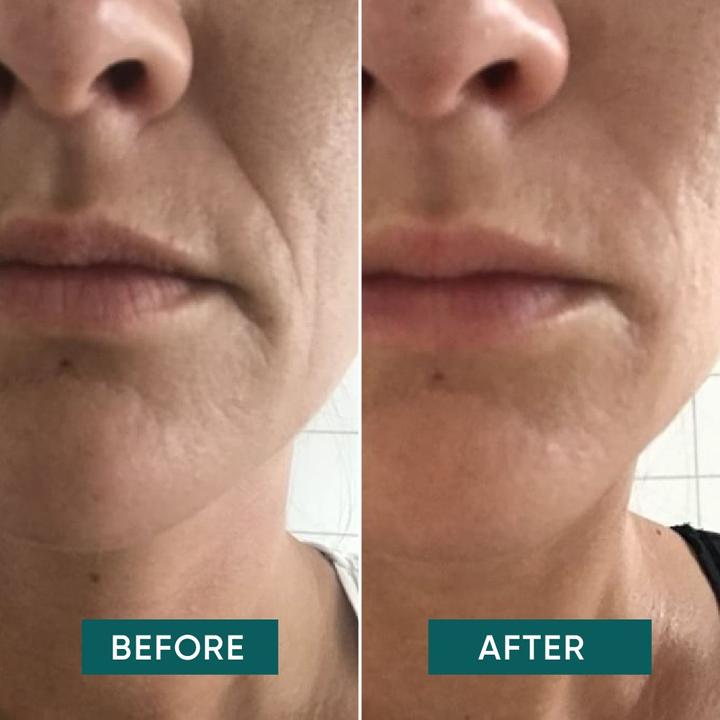 Produktbild Apricot - Wiederverw. Mund Pad Mit Hyaluron I Love Your Smile - 2 Stk.