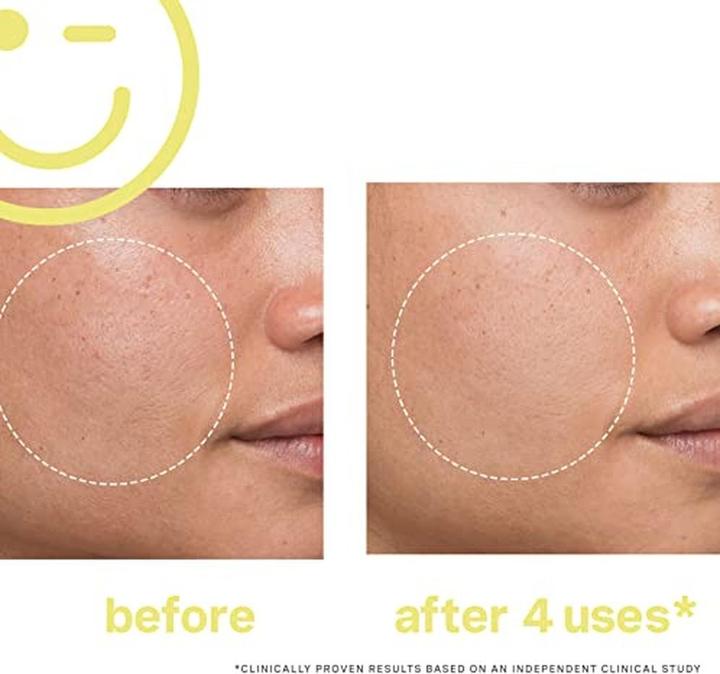 Produktbild Kate Somerville Mega-C (59.60 ml)