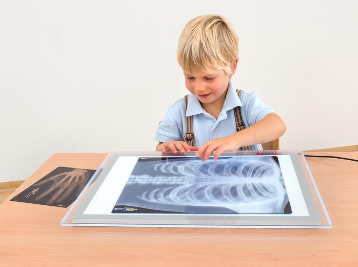 Produktbild Roylco Röntgenbilder Mensch