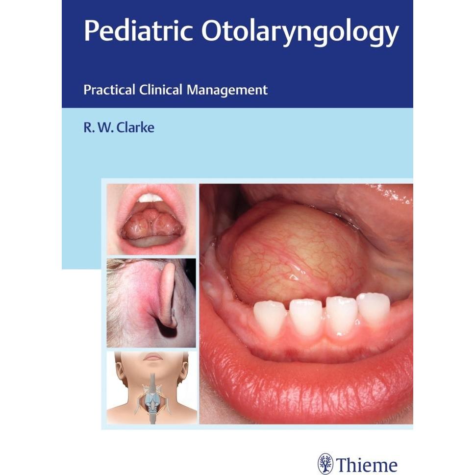 Clarke:Pediatric Otolaryngology: Practi, Sachbücher von Raymond Clarke
