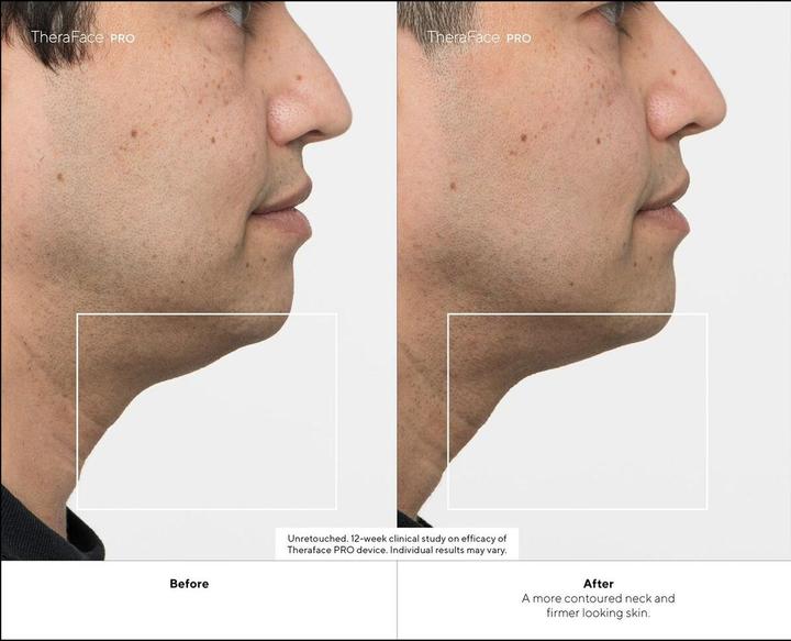 Produktbild Therabody TheraFace PRO, schwarz