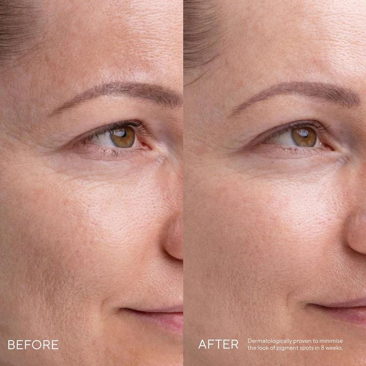 Actual product image Madara Kojic Alternative Pigment Serum (30 ml)