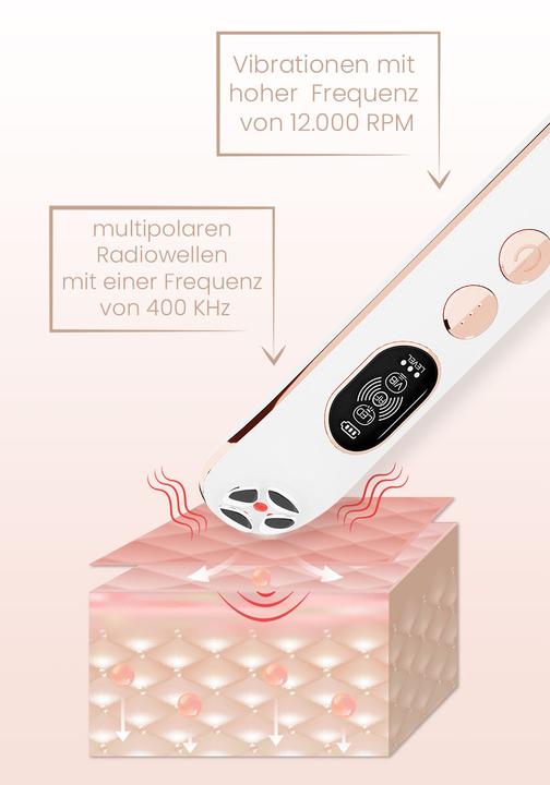 Actual product image Beautifly B-Looky Pro