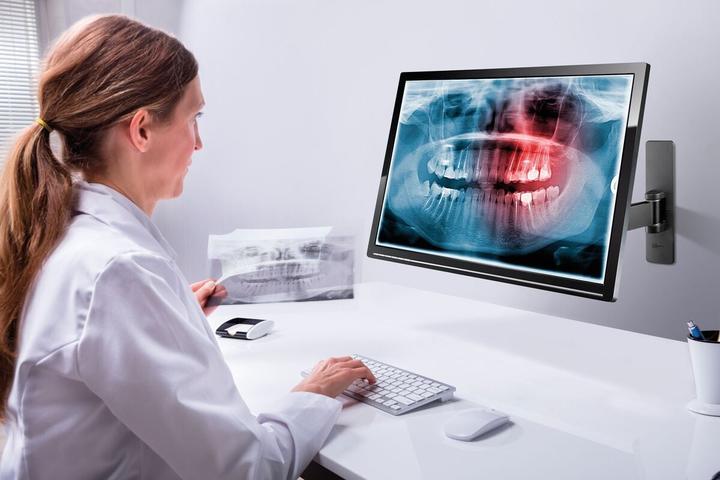 Productafbeelding Vogels PFW 1020 DISPLAY MUURBEVESTIGING TUR (Muur, 28", 16 kg)