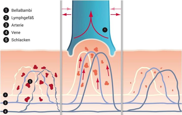 Produktbild K-Active Bellabambi Mini Set