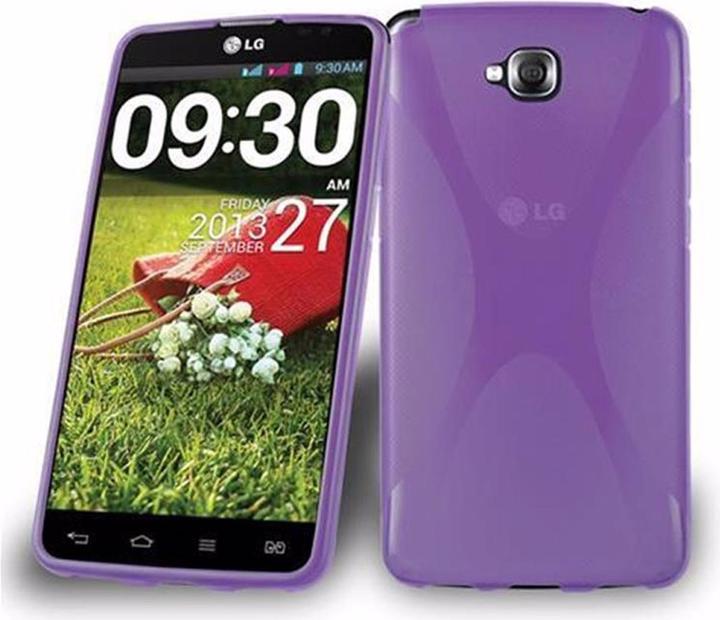Actual product image Cadorabo TPU X-Line Cover (LG G Pad Pro Lite)