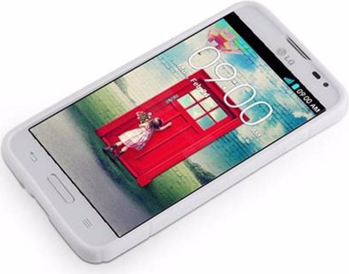 Actual product image Cadorabo TPU S-Line Cover (LG L70)