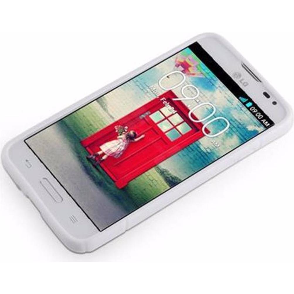 Thumbnail - Cadorabo TPU S-Line Cover (LG L70), Smartphone Hülle, Weiss