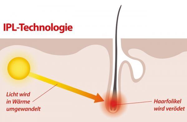 Immagine prodotto Sichler Sistema di depilazione IPL con attacco luce e occhiali protettivi
