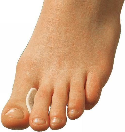Actual product image Süda Intermediate toe pad (Decompression)