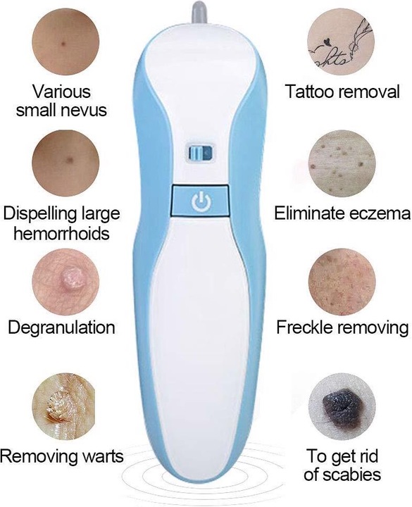 Actual product image Filfeel Birthmark Remover