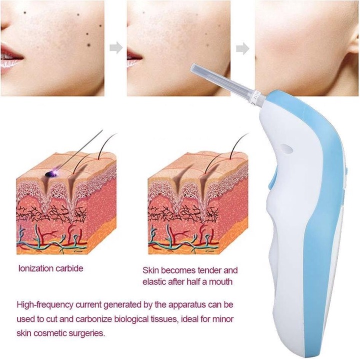 Actual product image Filfeel Birthmark Remover
