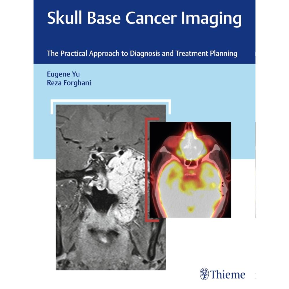 Yu:Skull Base Cancer Imaging, Fachbücher von Reza Forghani, Eugene Yu