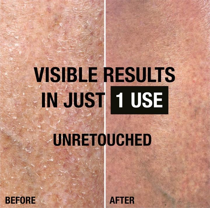 Produktbild Neutrogena Geschenkset Körperpflege Intensive Regeneration (Körperpflegeset)