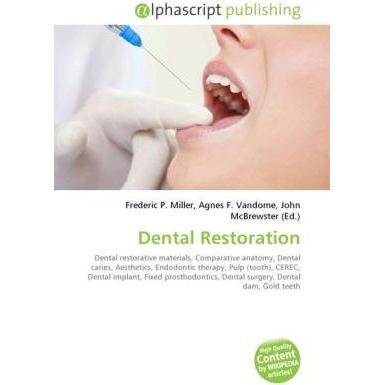 Dental Restoration, Fachbücher von Agnes F. Vandome, Frederic P. Miller, John McBrewster