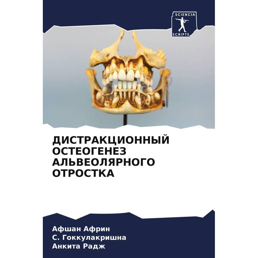 Distrakcionnyj Osteogenez Al'Veolyarnogo Otrostka, Fachbücher von S. Gokkulakrishna, Afshan Afrin, Ankita Radzh