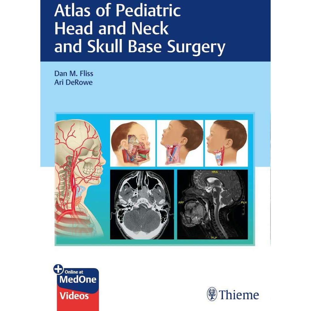 Atlas of Pediatric Head and Neck and Skull Base Surgery, Fachbücher von Dan M. Fliss, Ari DeRowe