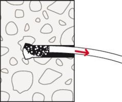 Produktbild Fischer Steigeisenbefestigung R 88589 FZA 14 / 40 ST A 4 Ohne Oberflächenangabe (20 Stk.)