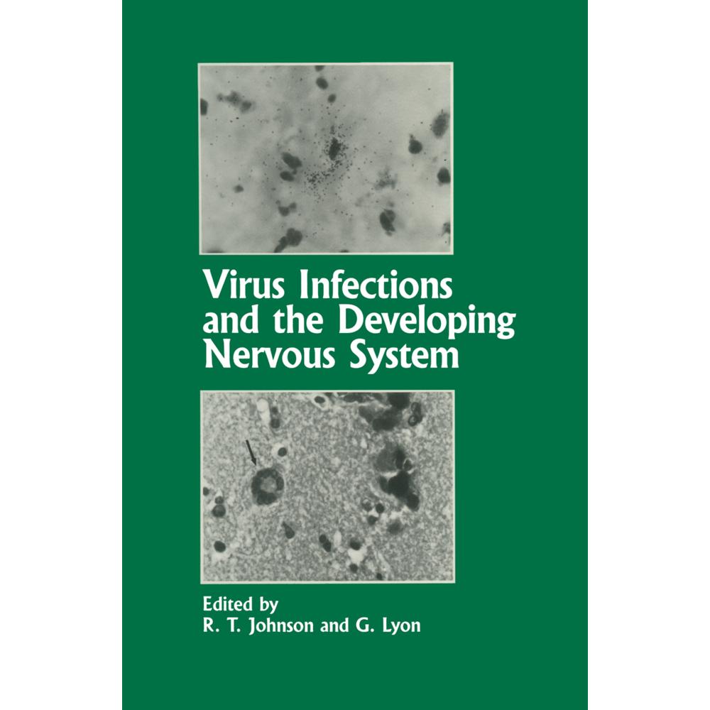 Virus Infections and the Developing Nervous System, Fachbücher von G. Lyon, R. T. Johnson