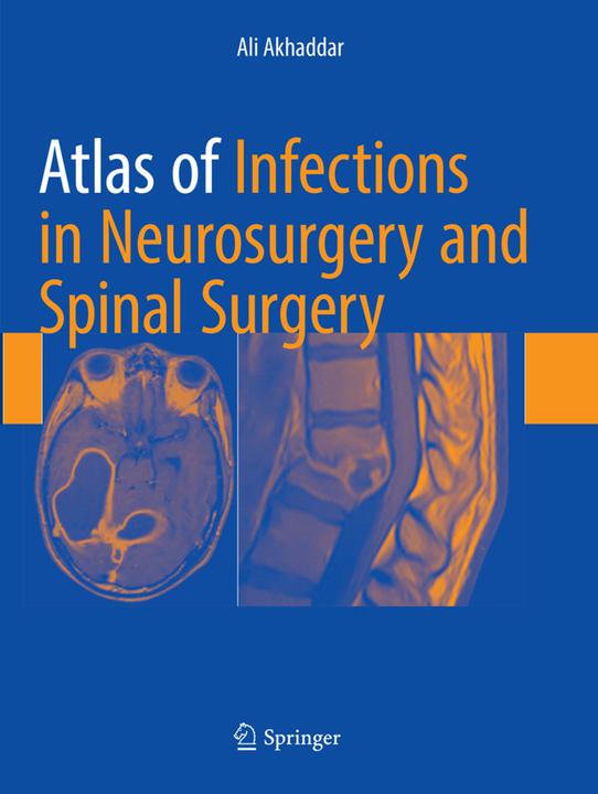 Produktbild Atlas of Infections in Neurosurgery and Spinal Surgery (Englisch, Ali Akhaddar, 2018)