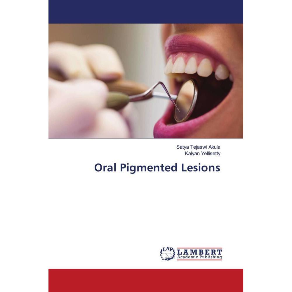 Oral Pigmented Lesions, Fachbücher von Kalyan Yellisetty, Satya Tejaswi Akula
