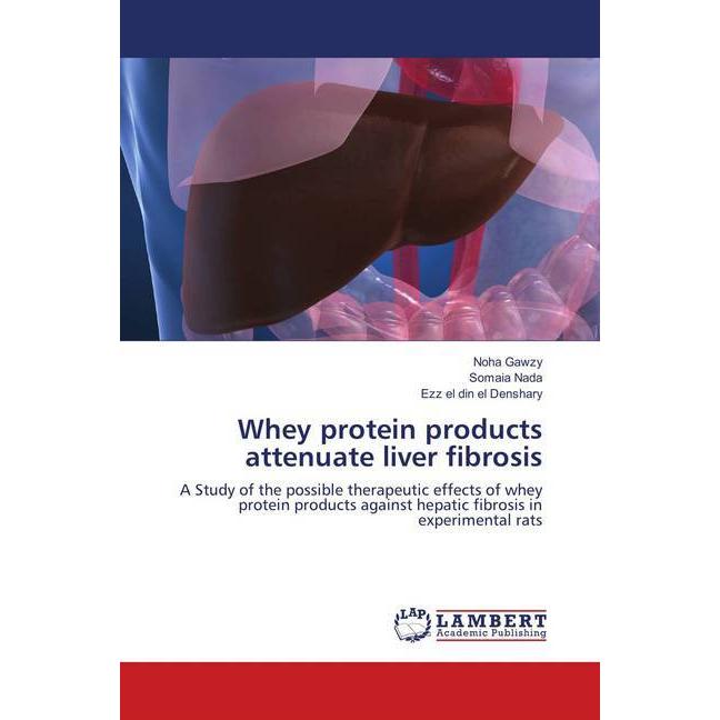 Whey protein products attenuate liver fibrosis, Fachbücher von Somaia Nada, Noha Gawzy, Ezz el din el Denshary