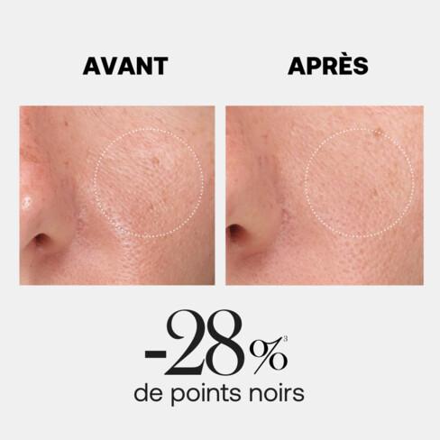 Image du produit Rexaline gommage gel en cellulose (Exfoliant nettoyant, 50 ml)