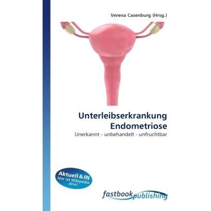 Unterleibserkrankung Endometriose, Fachbücher