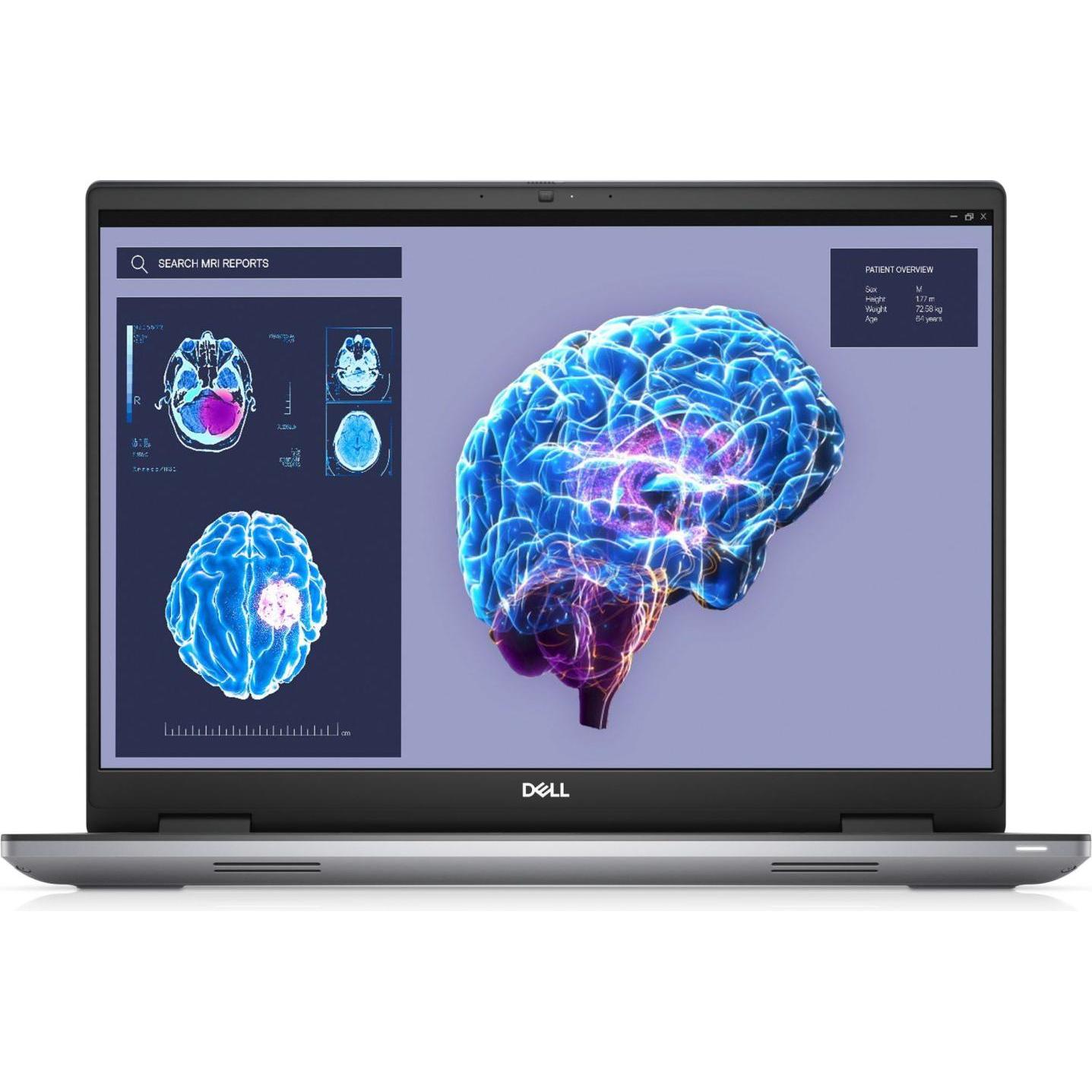 Dell Precision 7680 (16", Intel Core i7-13850HX, 1000 GB, 1000 GB, DE), Notebook, Grau