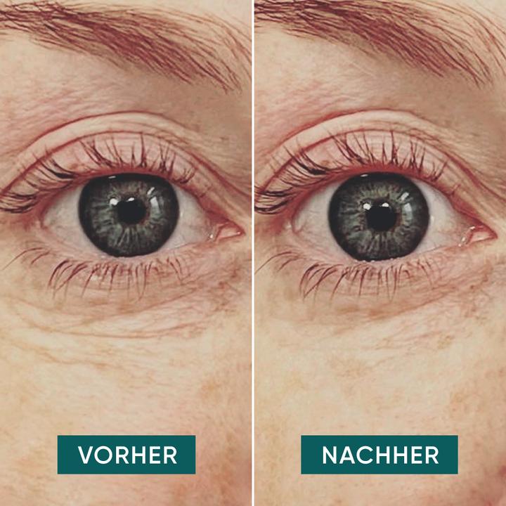 Produktbild Apricot wiederv. Augen Pads Vitamin C “glow getter” (Augenpatches)