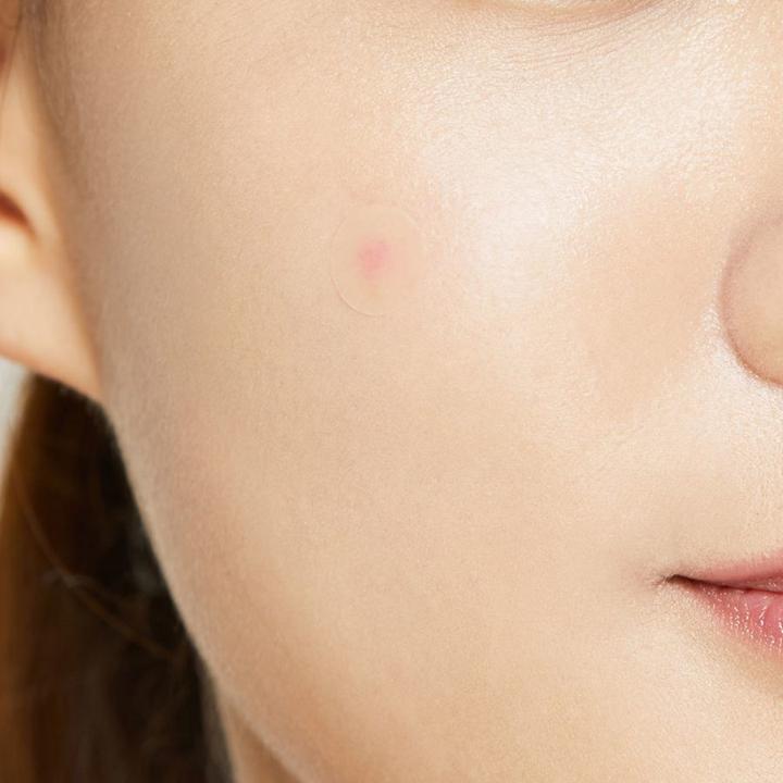 Actual product image Cosrx Acne Pimple Master